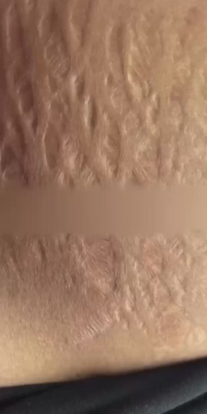 Sérum Antiestrías Ciara ✨ Piel Más Lisa, Firme e Hidratada