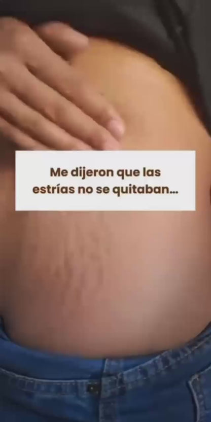Sérum Antiestrías Ciara ✨ Piel Más Lisa, Firme e Hidratada